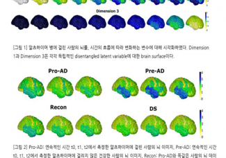 [김원화 교수] 알츠하이머에 걸린 뇌의 특성을 분석 가능한 딥러닝 모델 개발